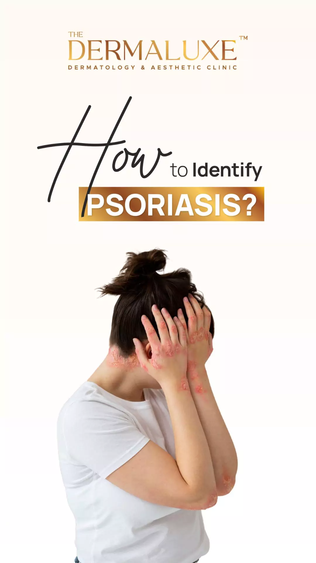 Psoriasis_12july