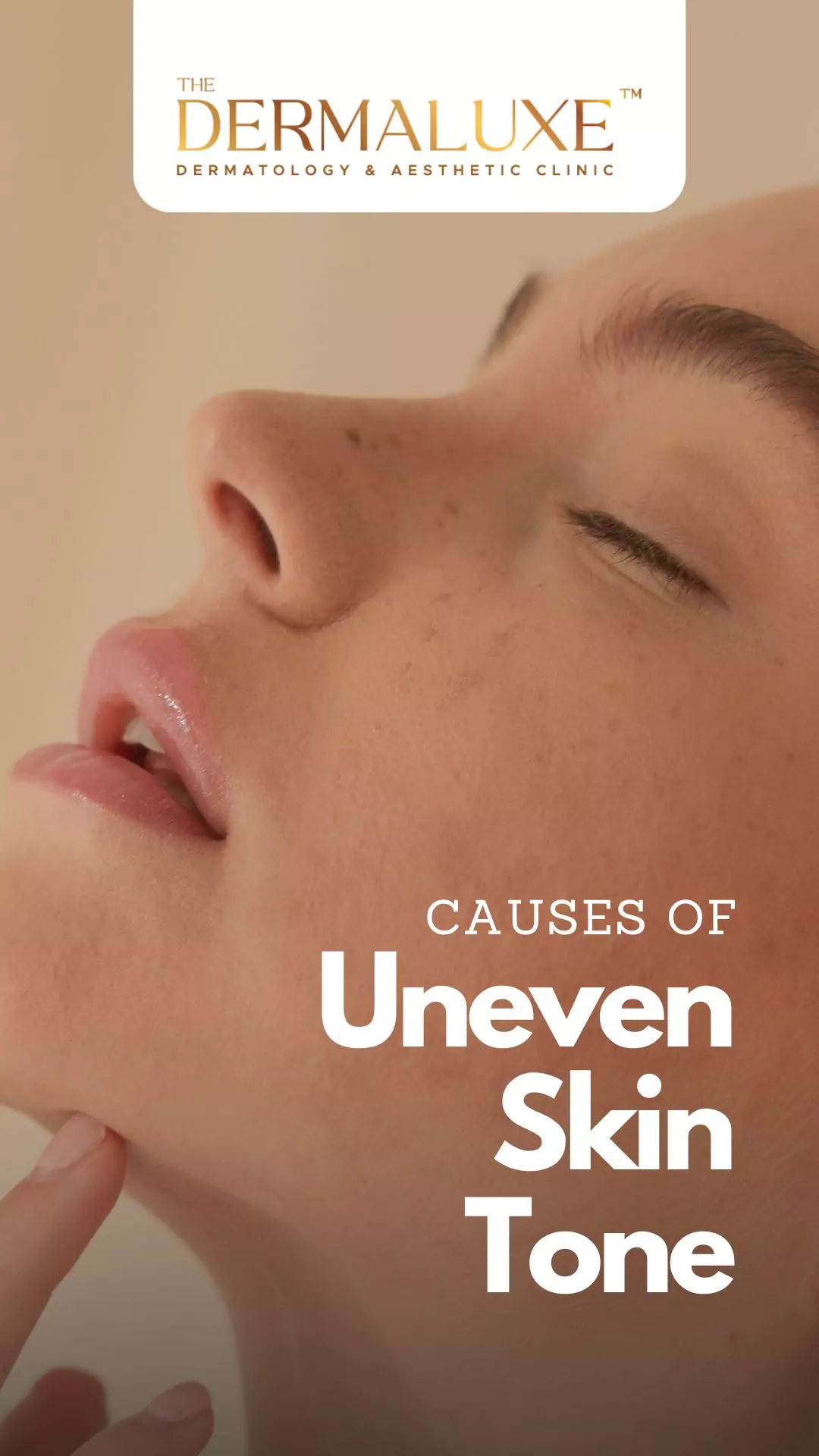 Scars and uneven skin_26june